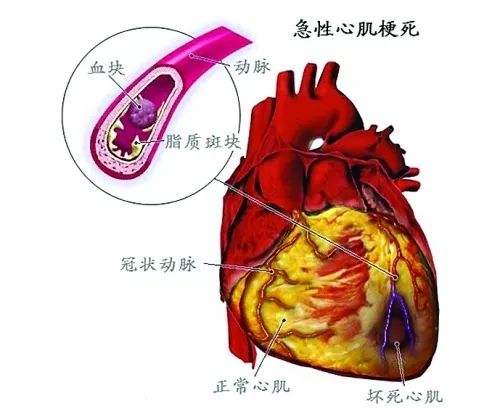 异病同治与预防性治疗(二)